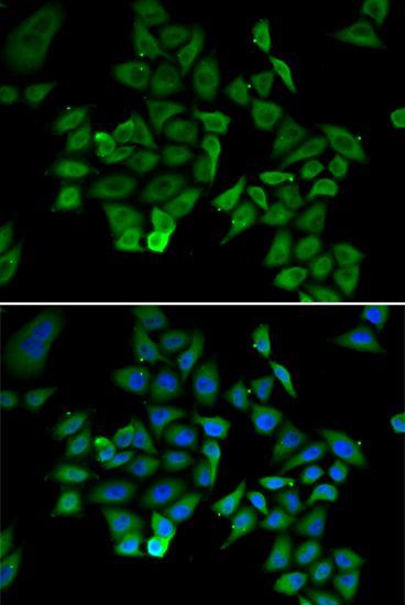 Immunofluorescence - NFKBIB antibody (144-05777)