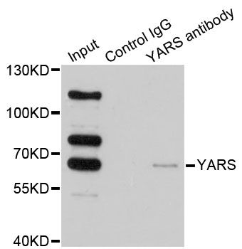 Immunoprecipitation - YARS Polyclonal Antibody (144-06791)