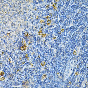 Immunohistochemistry - GLRX Antibody (144-05315)