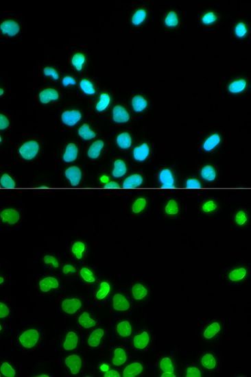Immunofluorescence - Lamin A/C Polyclonal Antibody (144-00249)
