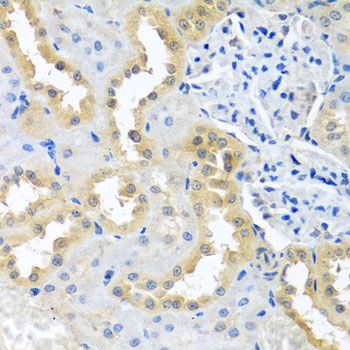 Immunohistochemistry - BCKDK antibody (144-08184)