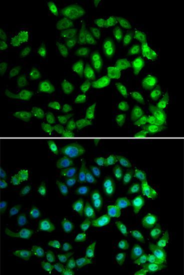 Immunofluorescence - GPS1 Polyclonal Antibody (144-06917)