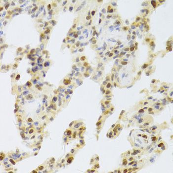 Immunohistochemistry - HDGF Antibody (144-05347)