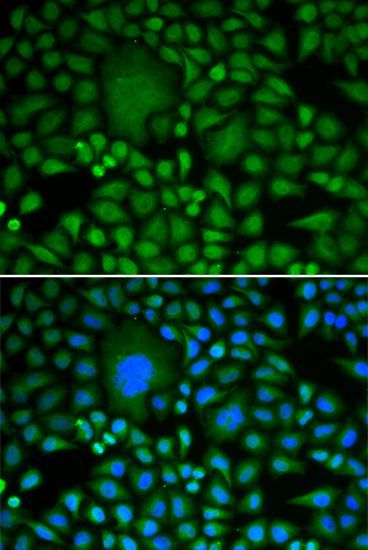 Immunofluorescence - DDX5 antibody (144-60268)