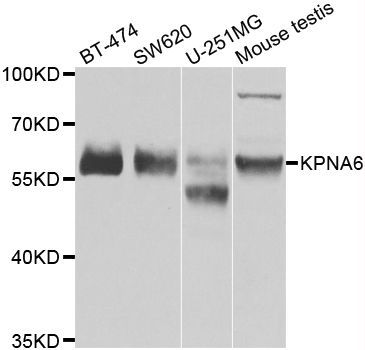 Western blot - KPNA6 antibody (144-07363)