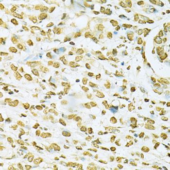 Immunohistochemistry - [KO Validated] HNRNPA2B1 Polyclonal Antibody (144-01162)