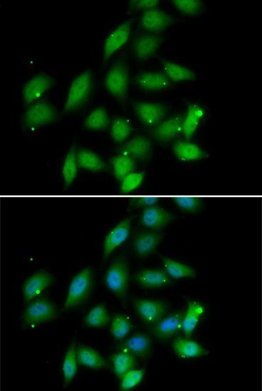 Immunofluorescence - PPP2CA antibody (144-06702)