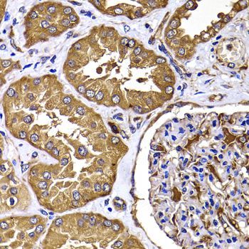 Immunohistochemistry - TGS1 antibody (144-07848)