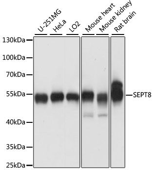 Western blot - SEPT8 antibody (144-60884)