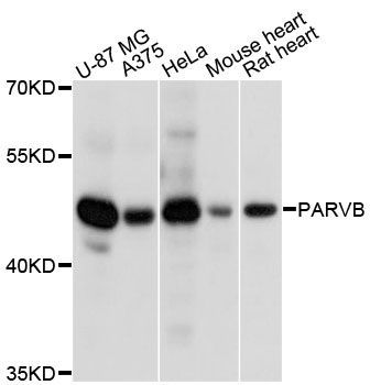 Western blot - PARVB antibody (144-013161)