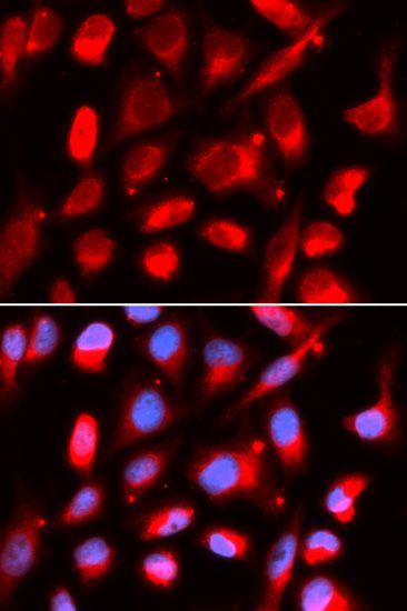 Immunofluorescence - UROD antibody (144-05493)