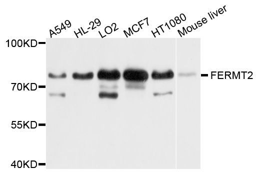 Western blot - FERMT2 antibody (144-08709)