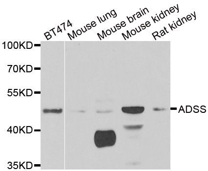 Western blot - ADSS Polyclonal Antibody (144-06516)