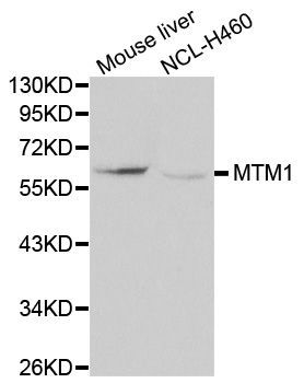 Western blot - MTM1 Polyclonal Antibody (144-00255)