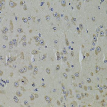 Immunohistochemistry - RPL9 Antibody (144-013632)