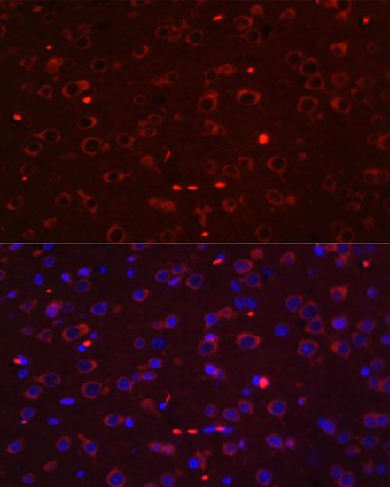 Immunofluorescence - STAT3 Polyclonal Antibody (144-01192)