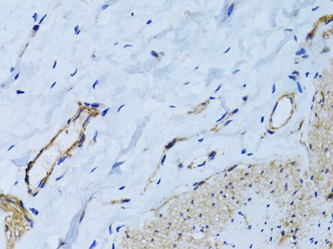 Immunohistochemistry - MCAM antibody (144-60521)