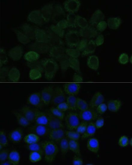 Immunofluorescence - CDH1 Polyclonal Antibody (144-03044)