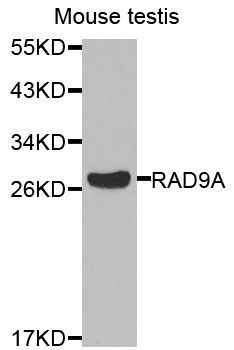 Western blot - RAD9A Polyclonal Antibody (144-01890)