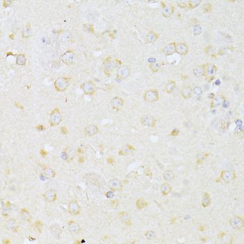 Immunohistochemistry - CHRNA7 antibody (144-01588)