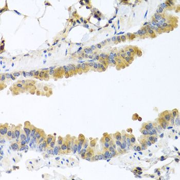 Immunohistochemistry - CPA1 antibody (144-03803)