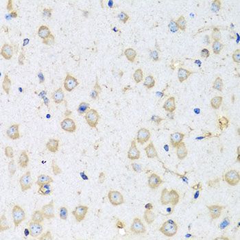 Immunohistochemistry - COTL1 antibody (144-04550)