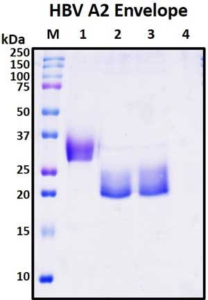 SDS-PAGE