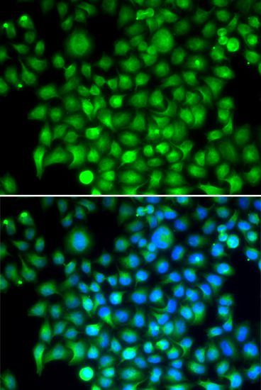 Immunofluorescence - CFI antibody (144-05623)