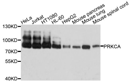 Western blot - PRKCA Polyclonal Antibody (144-602922)