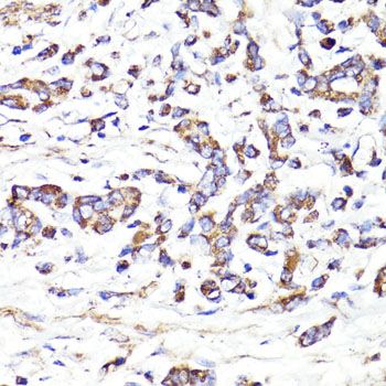 Immunohistochemistry - IGF2R Polyclonal Antibody (144-60151)