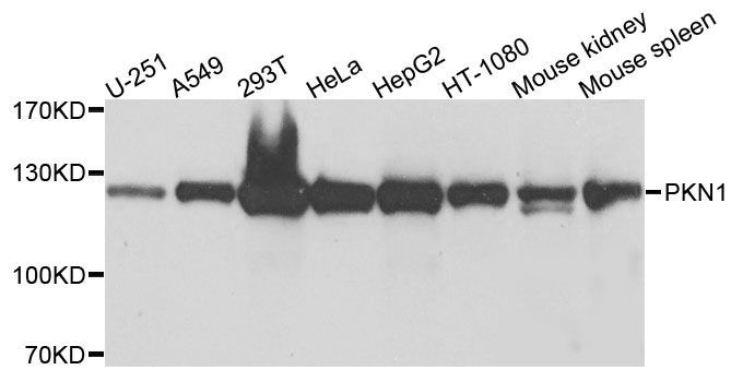 Western blot - PKN1 Polyclonal Antibody (144-00553)
