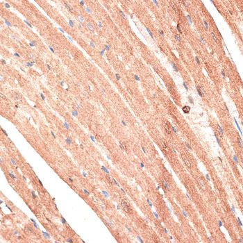 Immunohistochemistry - KTN1 antibody (144-012456)