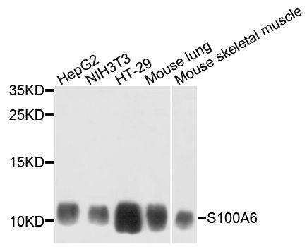 Western blot - [KO Validated] S100A6 Polyclonal Antibody (144-04104)