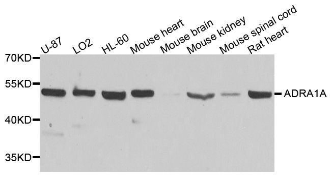 Western blot - ADRA1A Polyclonal Antibody (144-01471)