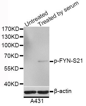 Western blot - Phospho-FYN-S21 antibody (144-50510)