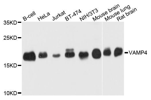 Western blot - VAMP4 antibody (144-04241)