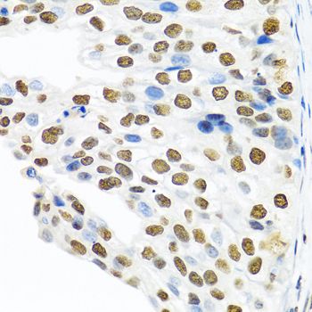 Immunohistochemistry - PTBP1 antibody (144-06107)