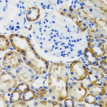 Immunohistochemistry - COMT Polyclonal Antibody (144-06200)