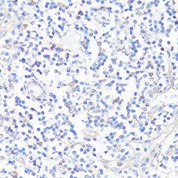 Immunohistochemistry - CASP3 Polyclonal Antibody (144-02156)