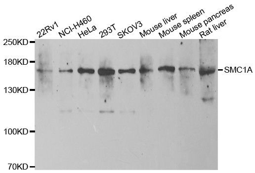 Western blot - SMC1A Polyclonal Antibody (144-07008)