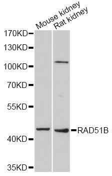 Western blot - RAD51B antibody (144-06962)