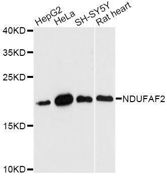 Western blot - NDUFAF2 antibody (144-60631)