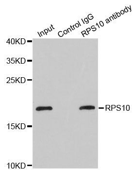 Immunohistochemistry - RPS10 Polyclonal Antibody (144-05880)