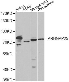 Western blot - ARHGAP25 antibody (144-60434)