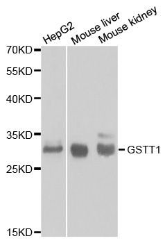 Western blot - GSTT1 antibody (144-01287)