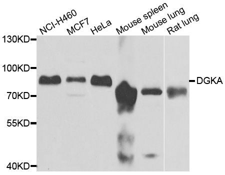 Western blot - DGKA antibody (144-06896)