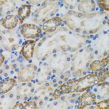 Immunohistochemistry - Caspase3 Polyclonal Antibody (144-60067)