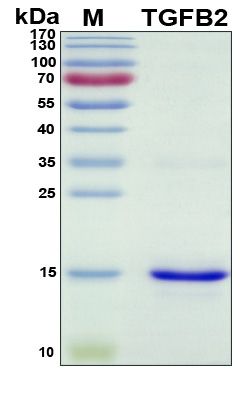 SDS-PAGE