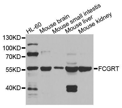 Western blot - FCGRT antibody (144-08544)