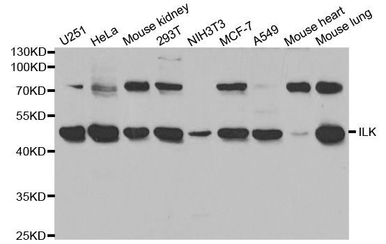 Western blot - ILK Polyclonal Antibody (144-00901)